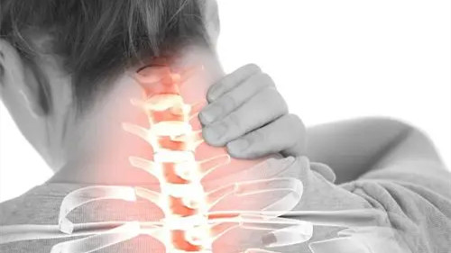 神经根型颈椎病是怎么回事儿?神经根型颈椎病能彻底治好吗
