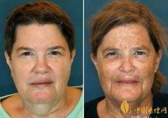 女生吸烟对外貌的影响